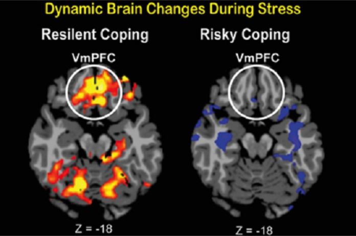 Cambios dinámicos del cerebro durante el estrés